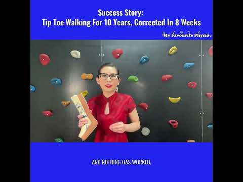 🔥🔥🔥Success Story: Tip Toe Walking For 10 Years,🧒 Corrected In 8 Weeks With Serial Casting