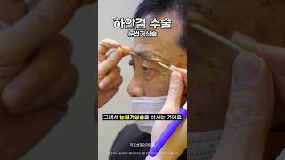 마이크로블레이딩 성형 시술