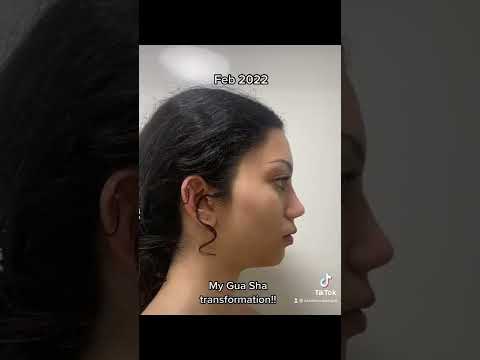 2 month Gua Sha transformation results / tutorial. reliable beauty gurus Bella hadid face lift tut