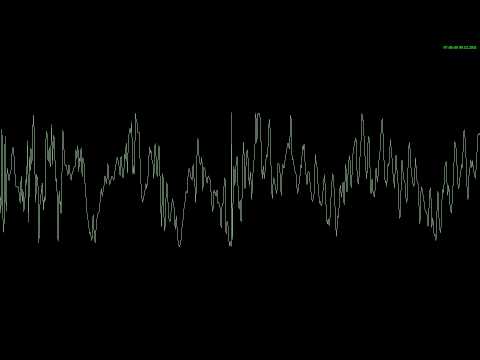 Steve Aoki & Laidback Luke feat. Lil Jon - Turbulence(DVJ Bazuka Remix)