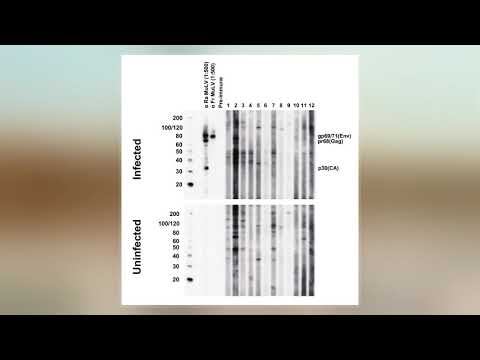 Xenotropic Murine Leukemia Virus-Related Virus