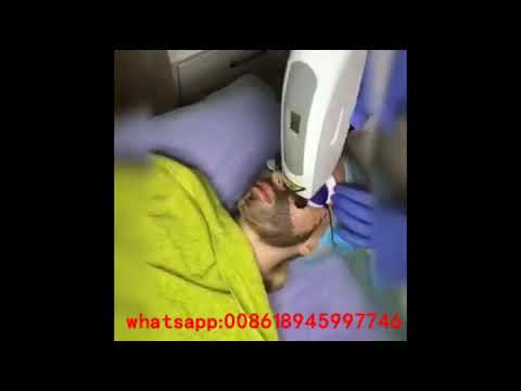 Неодимовый лазер по удалению тату монализа