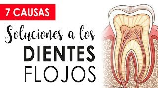 CUIDADO CON LOS DIENTES FLOJOS | CAUSAS Y SOLUCIONES 😱