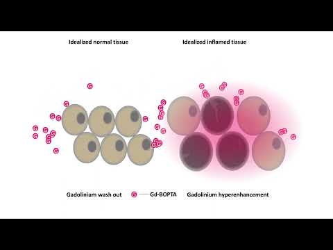 Mode of action for extracellular CAs in CT or MRI