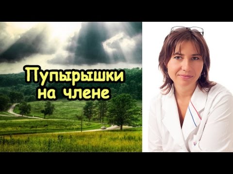Удалять веснушки летом Как лучше удалить пигментные пятна на лице