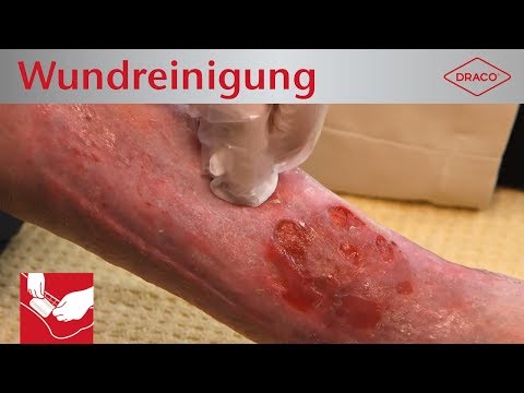 Prostata-Massage Punkt p Dehnen und Prostatitis