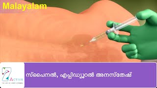 SPINAL & EPIDURAL ANAESTHESIA | Malayalam
