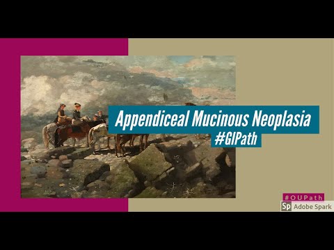 Appendiceal Mucinous lesions