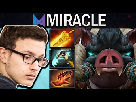 Pudge Dota 2 Gameplay Miracle with 20 Kills and Radiance