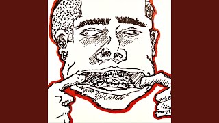 Cover art for Braces