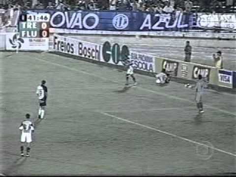 Copa do Brasil 2005: Treze e Fluminense no Estádio Amigão (Jogo Completo)