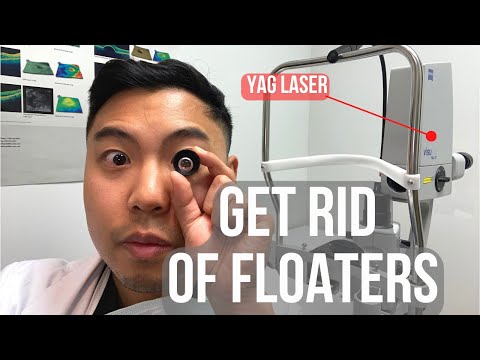 How to get rid of floaters in 2 MINUTES. (BUT IS IT SAFE?) | Ophthalmologist @MichaelRChuaMD