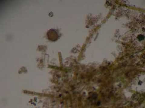 Pond Scum Under MIcroscope