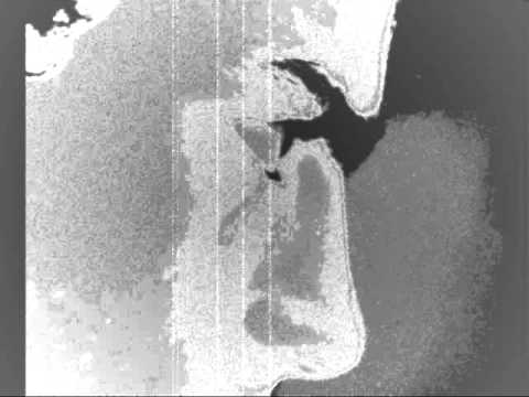 Ast - razlozene supstance