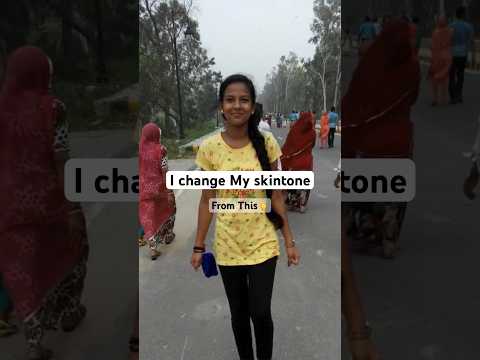 I change my skin tone #skincare#skin#viral#shorts #youtubeshorts