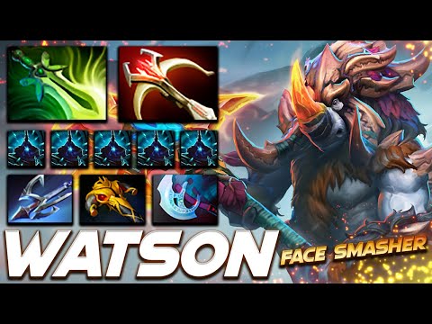 Watson Magnus Face Smasher - Dota 2 Pro Gameplay [Watch & Learn]