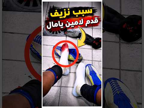 السبب المرعب وراء نزيف قدم لامين يامال 😳🩸