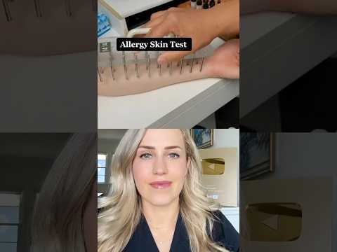 THIS is how allergy testing works