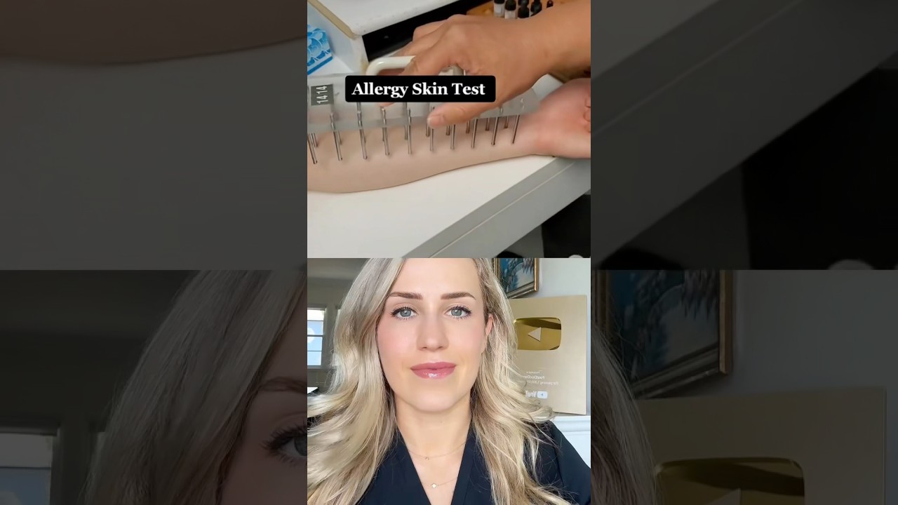 THIS is how allergy testing works