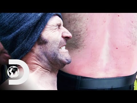 潛水員在挖金子時被化學物品燒傷｜淘金熱：白水 (Diver Suffers Chemical Burns While Dredging For Gold | Gold Rush: White Water)