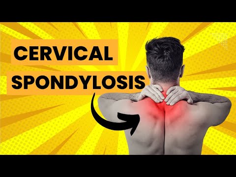 Cervical Spondylosis- Exercises & Stretches for Neck Pain & Arthritis