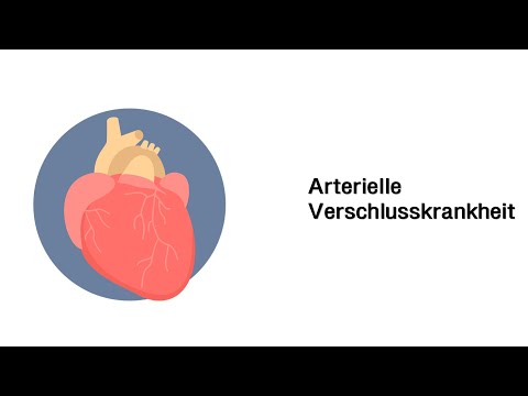 Arterielle Verschlusskrankheit (AVK) - Erkrankungen der Gefäße und des Kreislauf