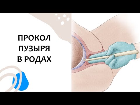 Видео: ikbTc-4N5JI