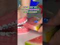 3 Ways NOT To Eat WATERMELON With BRACES What To Eat Instead Braces Watermelon Summer
