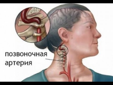 4 месяца болит шея Что делать если болят суставы после алкоголя