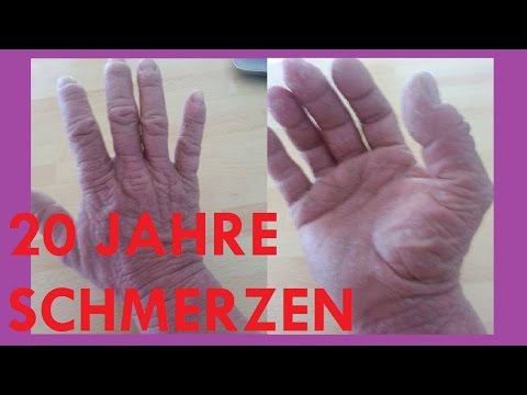 Die Einstiche von der Schuppenflechte auf dem Kopf Wie von der Schuppenflechte geheilt wurde