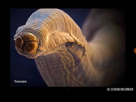 Il bambino ha vermi di ascarid che fare Come trattare vermi e pinworms a bambini di komarovskiya