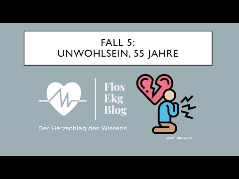 Fall der Woche: Bifaszikulärer Block und ein unregelmäßiges EKG