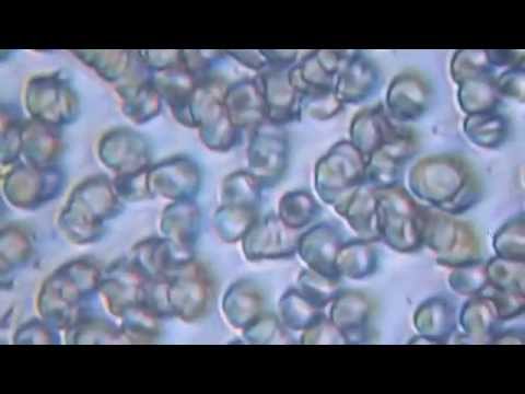 Come striscia a unocchiata di vacca Posti o parassiti della persona