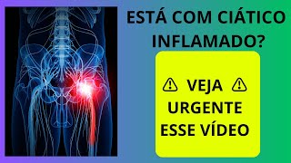 CIÁTICO INFLAMADO: TRATAMENTO EM CASA ⚠️VEJA URGENTE⚠️ MELHORE O NERVO CIÁTICO INFLAMADO