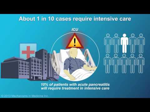 Management and Treatment of Acute Pancreatitis