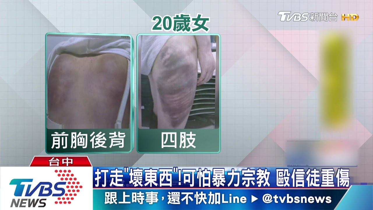 可怕暴力宗教!打走「壞東西」 把人毆打成傷