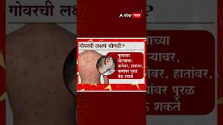 Mumbai Dharavi Measles : Govar चा प्रसार रोखण्यासाठी BMC चं Mission धारावी काय आहे?