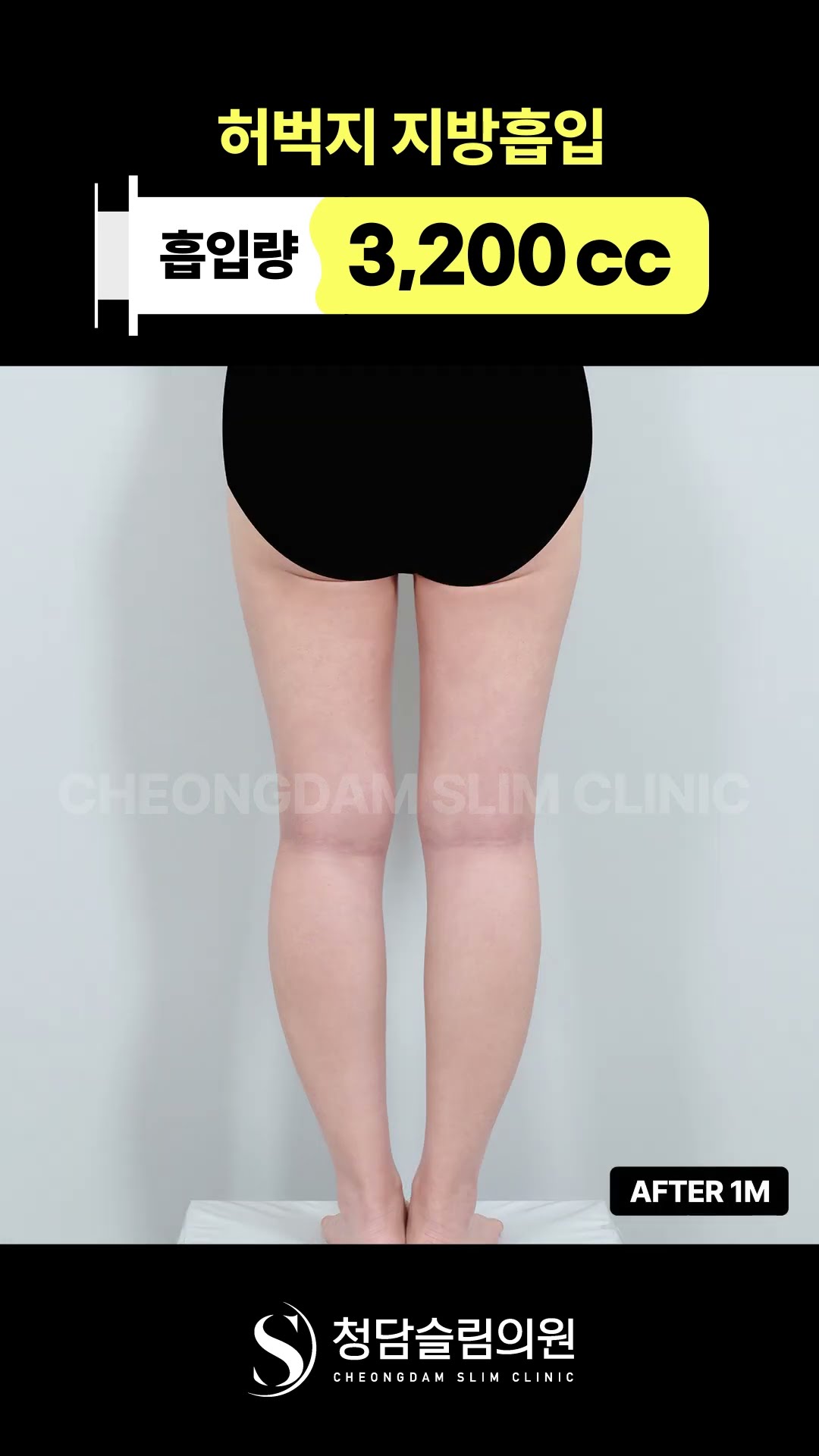 허틈? 한달차부터 보이는데??🫢