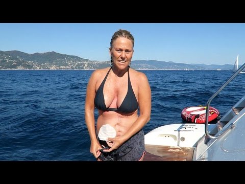 Zo heb je seks met een stoma