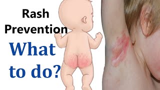 How to prevent baby from rash (diaper & other body rashes) | Newborn baby development