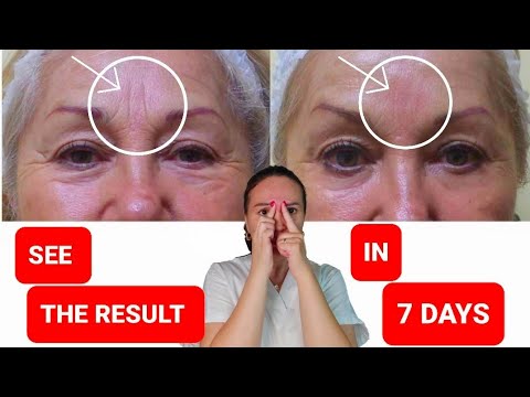 Get rid of FROWN LINES | Reduce FOREHEAD WRINKLES