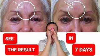 Get rid of FROWN LINES | Reduce FOREHEAD WRINKLES