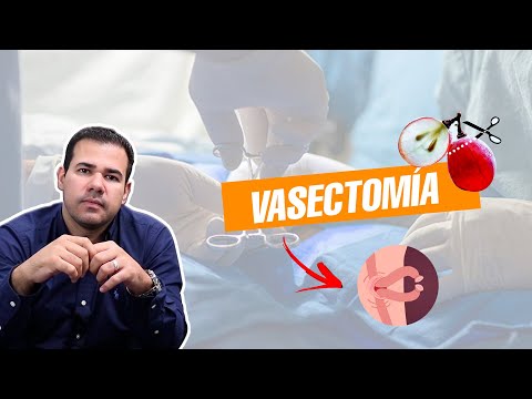 ¿Qué tan DOLOROSA es la Vasectomía?