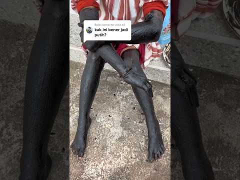 Kulit jadi putih pake lulur hitam henny #beddalotong #lulur #fypシ