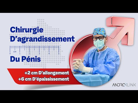 Chirurgie d'agrandissement du pénis (+2 cm d'allongement, +6 cm d'épaississement)