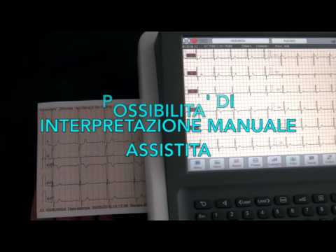 download lagu mp3 mp4 Elettrocardiografo 6 Canali, download lagu Elettrocardiografo 6 Canali gratis, unduh video klip Elettrocardiografo 6 Canali
