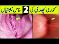 Kanwari Phudi Ki 2 Khas Nishanian Baba Health Tips