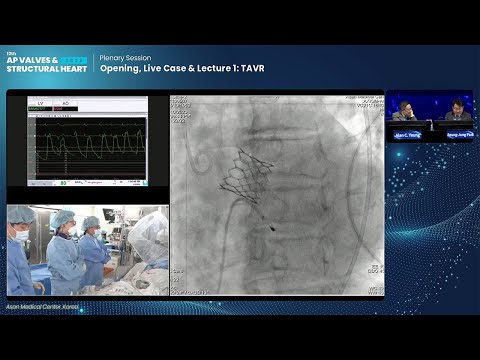 [AP VALVES & SH 2023] Opening, Live Case & Lecture 1: TAVR