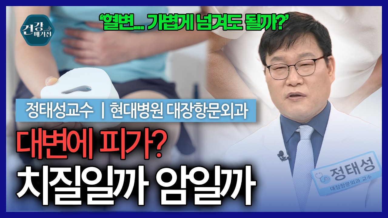 혈변, 단순 치질일까요? 아니면 대장 질환의 신호일까요? [건강매거진]