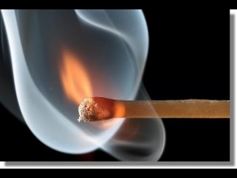 Cambiamenti parenchimali diffuse e calcificazione della prostata che è Prostata stimolatore buy spunti